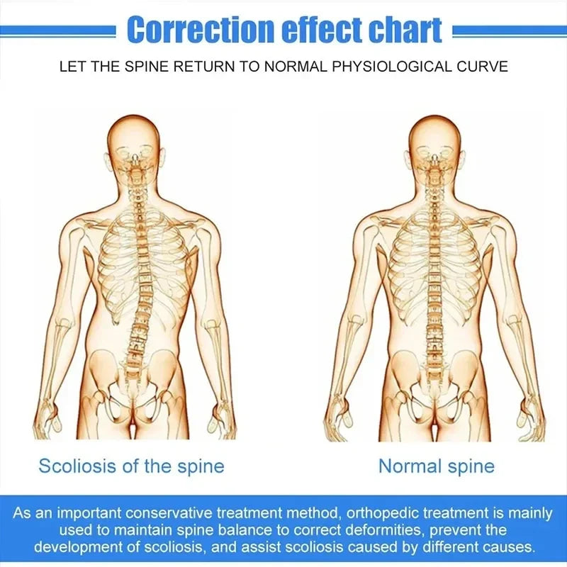 Fixed Spinal Alignment Brace