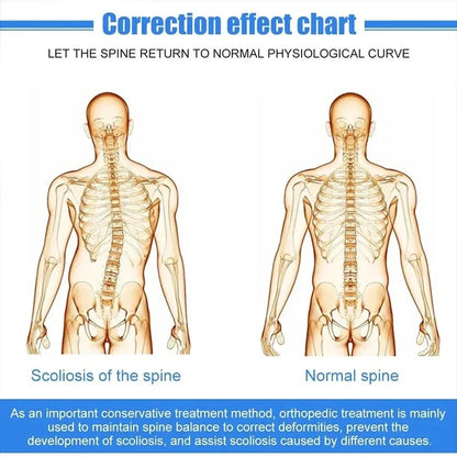 Fixed Spinal Alignment Brace